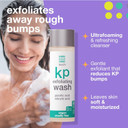 Touch Keratosis Pilaris Exfoliating Body Wash Cleanser - Kp Body Wash With 15% Glycolic Acid, Aloe Vera, & Hyaluronic Acid - 8 Ounce Touch Keratosis Pilaris Exfoliating Body Wash Cleanser - Kp Body Wash With 15% Glycolic Acid, Aloe Vera, & Hyaluronic Acid - 8 Ounce