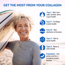 Biotrust Collagen Powder With Turmeric  5 Types (I, Ii, Iii, V, X)  Turmeric Collagen Powder For Women & Men  Hydrolyzed Protein  Grass Fed Beef, Fish, Chicken, Eggshell Membrane (Golden Milk)