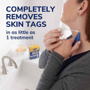 Dr. Scholl'S Freeze Away Skin Tag Remover, 8 Ct // Removes Skin Tags In As Little As 1 Treatment, Fda-Cleared, Clinically Proven, 8 Treatments