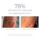 Derma E Crepey Skin Repair Treatment  Restorative Moisturizer Lotion  Body Cream For Dry Crepey Skin  Skin Firming Cream Improves Skin Elasticity And Thickness, 6 Oz