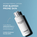 Jan Marini Skin Research Benzoyl Peroxide Acne Treatment Lotion 5% - 4 Oz