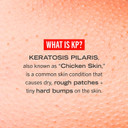 First Aid Beauty Kp Bump Eraser Body Scrub Exfoliant For Keratosis Pilaris With 10% Aha  8 Oz + Bonus 1 Oz Travel Size Tube