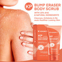 Kp Bump Eraser Body Scrub, Bump Eraser Body Scrub, Keratosis Pilaris Treatment, Strawberry Legs Treatment For Women, Kp Bump Eraser, Kp Body Scrub, Exfoliating Body Scrub For Women & Men Exfoliation