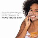 Neutrogena Facial Cleansing Bar Treatment For Acne-Prone Skin, Non-Medicated & Glycerin-Rich Formula Gently Cleanses Without Over-Drying, No Detergents Or Dyes, Non-Comedogenic, 3.5 Oz
