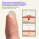 Curology Emergency Spot Pimple Patches For Face, Hydrocolloid Pimple Patches Fast-Acting Support, Spot Concealing And Oil Absorbing, 40 Count