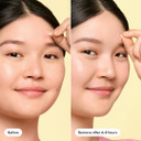 Hero Cosmetics Mighty Patchã¢Â Mini Invisible+ Patches ÃÂ Extra Small Daytime Hydrocolloid Acne Pimple Patches For Covering Zits And Blemishes, Blends Into Skin And Barely There (30Ct 10Mm Patches)