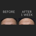 Kate Somerville Exfolikate Glow Moisturizer  Clinically Formulated Daily Face Cream  Gently Exfoliating And Hydrating Kate Somerville Exfolikate Glow Moisturizer  Clinically Formulated Daily Face Cream  Gently Exfoliating And Hydrating