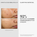 Murad Clarifying Water Gel