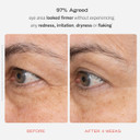 First Aid Beauty 0.3% Retinol Complex Serum With Peptides & Retinol Eye Cream With Squalane + Ceramides  Improve The Look Of Lines & Wrinkles With Less Irritation Than Traditional Retinol