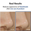 Isntree Hyper Acid 4 (Aha Bha Pha Lah) 30 Serum 20Ml | Wash-Off Serum | Gentle Chemical Exfoliant | Korean Skincare