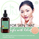 Skin Calming And Relief Serum | Best Skin Therapy For Redness, Rosacea & Irritated Skin | Perfect Moisturizer For Dry Or Sensitive Skin | All Natural Ingredients For Long Lasting Relief
