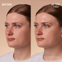 L'Occitane Immortelle Overnight Reset Oil-In-Serum: More Radiant Skin In 1 Night, Smooth Fine Lines, Revitalize Dull Skin, Award-Winner