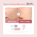 Medicube Zero Exosome Shot 2,000 Ppm Spicule Facial Serum | Liquid Skin Booster Serum | Exosome, Aha+Bha+Pha | Pore Care, Dead Skin Cells, Skin Texture | Korean Skin Care 1.01 Fl.Oz Medicube Zero Exosome Shot 2,000 Ppm Spicule Facial Serum | Liquid Skin Booster Serum | Exosome, Aha+Bha+Pha | Pore Care, Dead Skin Cells, Skin Texture | Korean Skin Care 1.01 Fl.Oz