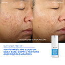 Murad Invisiscar Resurfacing Treatment