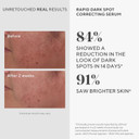 Murad Rapid Dark Spot Correcting Serum - Skin Brightening Face Serum For Hyperpigmentation - Glycolic Acid Treatment Backed By Science