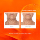 Naturium Vitamin C Complex Face Serum Jumbo, Anti-Aging Facial Treatment With Hyaluronic Acid & Vitamin E, 2 Oz