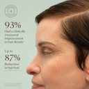 Vegamour Gro+ Advanced Hair Serum | Improves Hair Density, Reduces Shedding And Promotes A Balanced Scalp | For Severe Signs Of Thinning | Formulated Without Fragrance, Vegan, Cruelty-Free