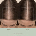 Vegamour Gro+ Advanced Balancing Shampoo | Lightly Exfoliates, Cleanses And Removes Buildup Without Stripping | For Severe Signs Of Thinning | Color Safe, Vegan, Cruelty-Free (8 Fl Oz)