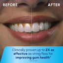 Waterpik Cordless Pulse Rechargeable Portable Water Flosser For Teeth, Gums, Braces Care And Travel With 2 Flossing Tips, Waterproof, Ada Accepted, Wf-20 White, Packaging May Vary