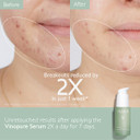Caudalie Acne-Prone Skin Essentials Set - Salicylic Acid Pore Minimizing Serum And Free Full Size Salicylic Spot Solution