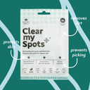 Nature Spell Clear My Spots Pimple Patches, Translucent Hydrocolloid Patches, Fast-Healing Acne Spot Treatment, Acne Patches, Pack Of 36