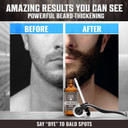 Viking Revolution Mens Facial Skin Care Kit - Includes Rejuvenating Face Moisturizer (5Oz) Microdermabrasion Facial Scrub (5Oz) Foaming Cleanser (5Oz) Eye Cream (1Oz)