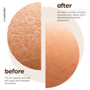 Artnaturals Natural Arabica Coffee Scrub- Body - Exfoliating And Rejuvenating Body Rub - For Skin Care, Stretch Marks, Acne And Cellulite - 20 Oz