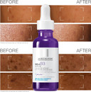 La Roche-Posay Mela B3 Serum, Dark Spot Corrector With Anti-Aging Melasyl + 10% Niacinamide, Discoloration Correcting Serum for Sun Spots, Age Spots & Post-Acne Marks, Long-Lasting Results, 30ML