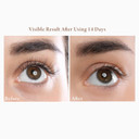 New Angance Refreshing And Firming Eye Cream Moisturizes The Tender Eye-Contour Skin Reduces Eye Bags Crow'S Feet Fine Lines, 0.7 Fl Ozfirming Eye Cream