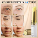 Retinol Eye Stick, Eye Cream For Dark Circles And Puffiness, Hydration And Brightening Eye Balm, Under Eye Cream Anti Aging Visible Results In 3-4 Weeks Reduces Fine Lines Bags