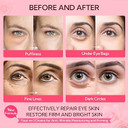 Under Eye Mask - 30 Pairs -Lanbrna Rose Eye Mask For Sleeping- Puffy Eyes & Dark Circles Treatments With Hyaluronic Acid, Reduce Under Eye Bags And Smooth Wrinkles, Brighten Complexionpink