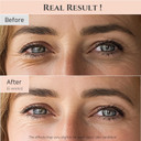 Beauty of Joseon Revive eye serum : Ginseng + Retinal, 30ml, 1fl.oz
