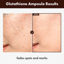 Glutathione Serum With 20,000Ppm Glutathione, Niacinamide And Hyaluronic Acid, Dark Spot, Improve Skin Elasticity, Revitalize Complexion, Korean Skincare, 30Ml, 1.01 Fl. Oz