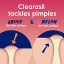 Clearasil Rapid Rescue Deep Treatment Acne Face Wash, Maximum Strenght With 2% Salicylic Acid Acne Medication, Acne Facial Cleanser, 6.78 Fl Oz6.78 Fl Oz (Pack Of 1)