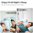 Sleep Strips, Anti Snoring Sleep Strips, Deeper Sleep and Reduced Snoring, Comfortable Sleep Tap, Anti Snoring Advanced Gentle Mouth Tape for Sleeping Stop Snoring