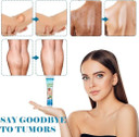 Lipoma Removal Care Cream – Mild Topical Formula for Neck, Shoulder & Body Lumps (20 g)