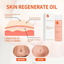 Stretch-Marks, Scar Treatment Oil - Boosts Collagen for Skin Lifting - Improves Treat of Scars, Stretch-Marks & Uneven Skin Tone - 125ml Stretch-Marks, Scar Treatment Oil - Boosts Collagen for Skin Lifting - Improves Treat of Scars, Stretch-Marks & Uneven Skin Tone - 125ml