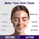 Purederm Nutritive Firming Hydro Pure Gel Mask (5 Pack) Hydrogel Face Mask For Firming & Elastic Skinnutiritive Firming