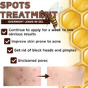 Bee Venom Acne Cream for Face - Acne Treatment Cream with B-ee Venom,Salicylic Acid,Tocopherol - Spot Treatment Creams for Rosacea,Pimples,Redness - Bee Ve-nom Ac-ne Scar Treat-ment for All Skin Types