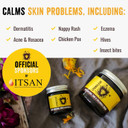 Zinc and Calendula Cream 100% Natural - for spots, blemishes, breakouts, rashes, acne, perioral dermatitis, rosacea and nappy rash 120ml