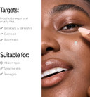 The INKEY List Succinic Acid Treatment 15ml, Clears Blemishes, Reduces Inflammation, Acne Treatment, Vegan Friendly, Suitable For All Skin Types