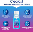 Clearasil Ultra Rapid Action Deep Pore Salicylic Acid Treatment Toner, Unclog Pores for A Visibly Clearer Skin, Remove Dirt & Spots, Pack of 3 x 200ml
