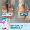 Flexitol Rapid Revive Overnight Foot Cream - 30 Percent Urea for Extremely Dry, Hard, Rough Skin on Feet - Results in 1 Night - Clinically Proven Foot Care - High Urea - Suitable for Diabetics. 50g Flexitol Rapid Revive Overnight Foot Cream - 30 Percent Urea for Extremely Dry, Hard, Rough Skin on Feet - Results in 1 Night - Clinically Proven Foot Care - High Urea - Suitable for Diabetics. 50g