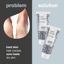 Foot Care Duo for Dry Feet and Cracked Heels - Moisturizing Foot Cream and Intensive Heel Repair for Soft and Smooth Skin - Soothing Formula with Antifungal Properties - Perfect for Athletes Foot