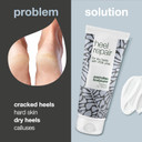 Australian Bodycare Cracked Heel Repair Cream 100ml | Tea Tree Oil Myrtle | Hard Skin Remover | 25% Urea Cream | Cracked Heel Balm | Heel Care for Dry & Cracked Feet | Australian Tea Tree Oil