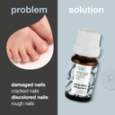 Nail Repair Oil with Natural 4-Terpineol Known from Tea Tree Oil  Treats Cracked, Rough, and Discolored Nails for Strong, Healthy Nails