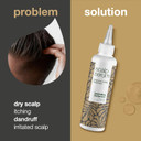 Scalp Treatment Products from Australian Bodycare for Dry, Itchy, Flaky Scalp & Hair, Dandruff, Spots & Pimples | Daily Care for People with Eczema or Psoriasis | Hair Cleanser for Men & Women (250ml)