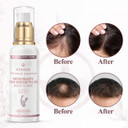 Kings 100% Natural Rosemary Oil with Biotin, Promotes Hair Growth & Prevents Loss, Organic Rosemary Oil for Hair Growth - Hair fall Solution for Dry, Damaged Hair for Men and Women  100 ml