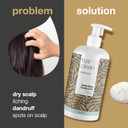 Shampoo 500 ml Mint With 4-Terpineol, Known from Tea Tree Oil  Anti Dandruff - For Itchy, Flaky, Dry Scalp - Psoriasis & Eczema Care - Scalp Pimples Shampoo 500 ml Mint With 4-Terpineol, Known from Tea Tree Oil  Anti Dandruff - For Itchy, Flaky, Dry Scalp - Psoriasis & Eczema Care - Scalp Pimples