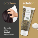 Shampoo With 4-Terpineol, Known from Tea Tree Oil  Anti Dandruff - For Itchy, Flaky, Dry Scalp - Psoriasis & Eczema Care - Scalp Spots & Pimples Shampoo With 4-Terpineol, Known from Tea Tree Oil  Anti Dandruff - For Itchy, Flaky, Dry Scalp - Psoriasis & Eczema Care - Scalp Spots & Pimples